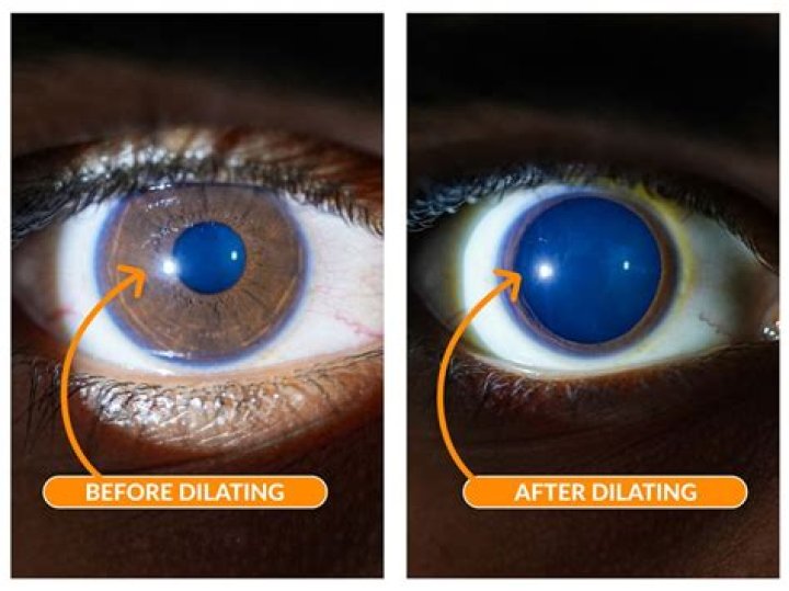 At what dilation Does your water break?