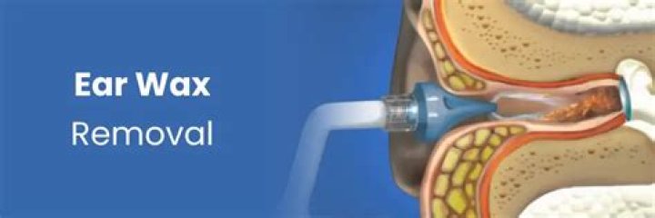 Can a doctor see ear wax build up?