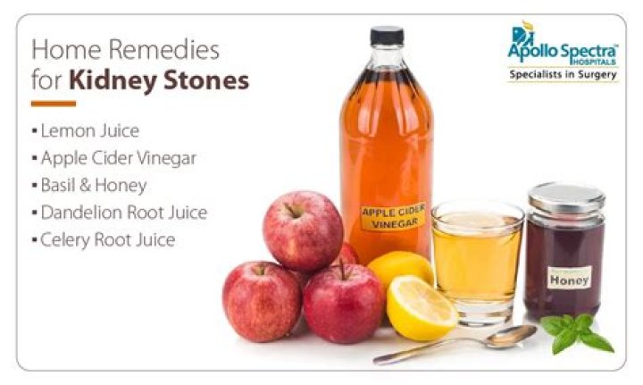 Does apple cider vinegar dissolve uric acid kidney stones?