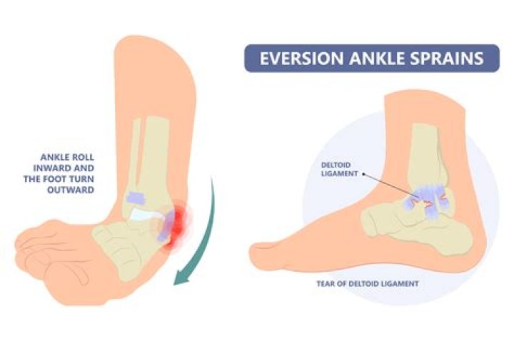 How long does it take for a pulled ligament in the ankle to heal?