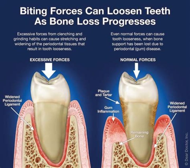 What does a loose tooth feel like?